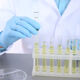 lab technician testing urine in vials